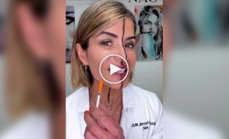 В США косметолог сделала инъекции ботокса в половину лица, чтобы показать его эффект