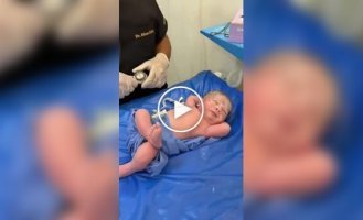 Новорожденный удивил своим спокойствием