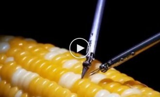 Невероятные навыки нейрохирургов