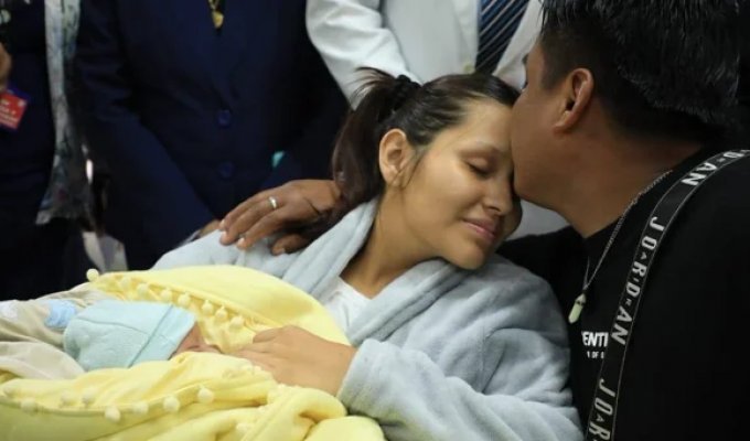 На свет появился ребёнок, развивавшийся в печени матери (4 фото)