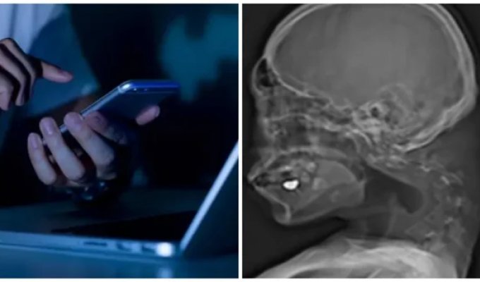 25-Year-Old Gamer Almost Loses the Ability to Raise His Head Because of His Phone (4 photos)