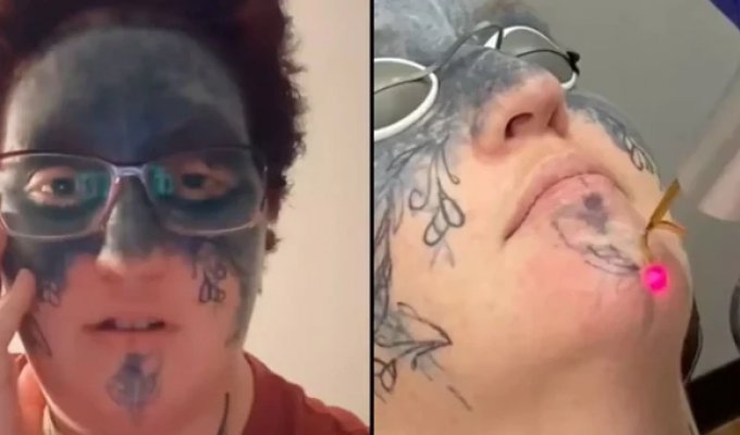 Woman removes forced tattoos from her face (4 photos + 1 video)