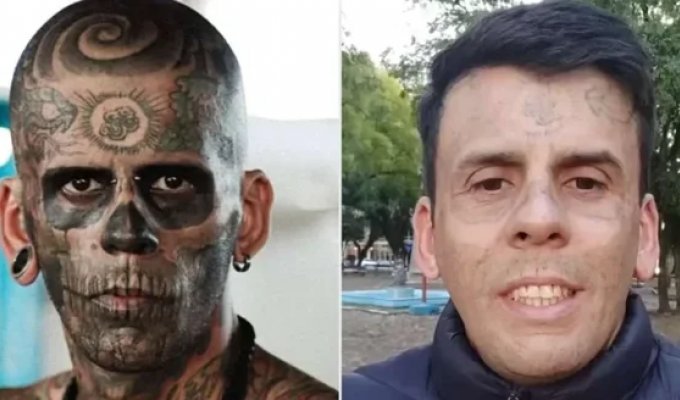 A Man Showed His Stunning Transformation After Laser Tattoo Removal (3 photos + 1 video)