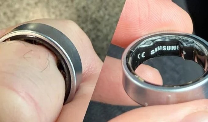 A Man Almost Lost His Finger Because of a Samsung Smart Ring (5 photos)