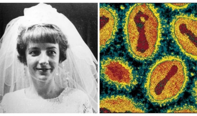 Последняя жертва побеждённой болезни: трагическая история Джанет Паркер (7 фото)