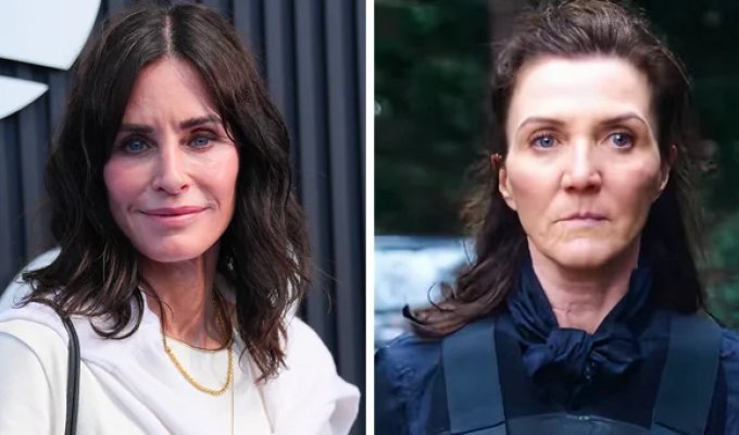 Who Looks Better: Celebrities of the Same Age With and Without Plastic Surgery (15 photos)