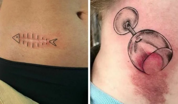 16 ingenious tattoos that helped people get rid of scars and birthmarks (17 photos)