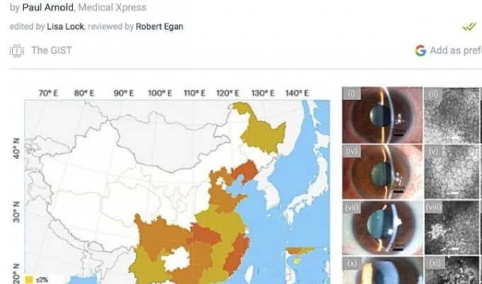 Сообщения о «новом вирусе» у любителей суши (фото)