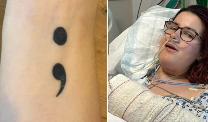 После операции девушка обнаружила татуировку с левой руки на языке (5 фото)