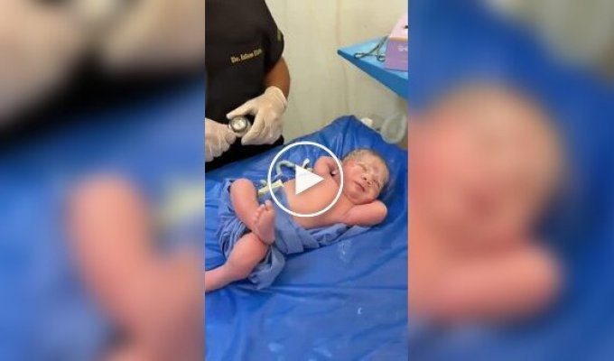 Новонароджений здивував своїм спокоєм