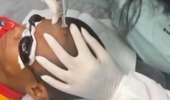 Хулиганы сделали оскорбительную татуировку на лбу мальчика (5 фото + 1 видео)