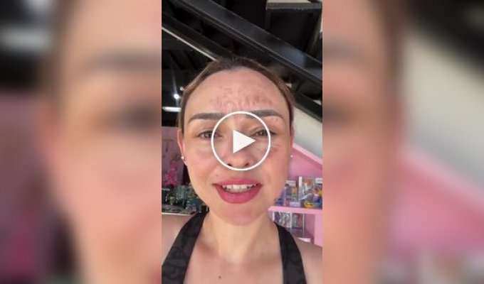 A girl suffered severe facial burns at a birthday party