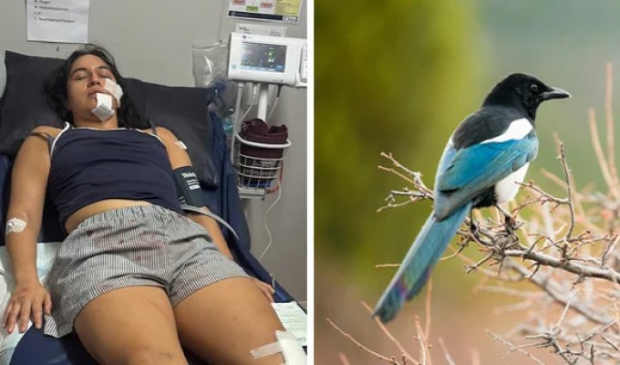 Женщине требуется операция после нападения сороки (4 фото)