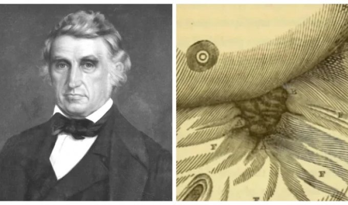 Alexis St. Martin: a man with a hole in his stomach who changed medicine (8 photos)
