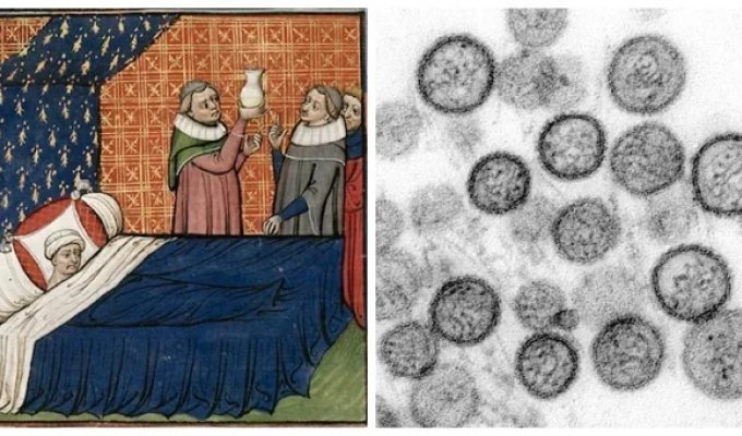 Sweating rash: a forgotten epidemic that mowed down aristocrats (9 photos)